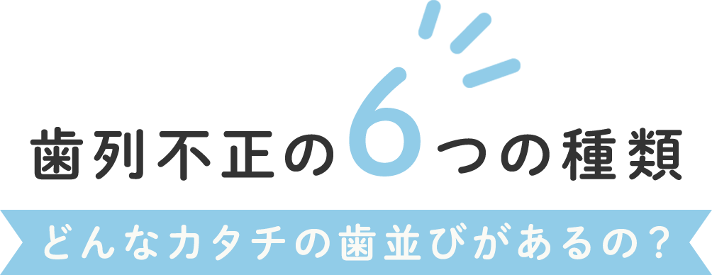 歯列矯正の6つの種類 どんなカタチの歯並びがあるの？