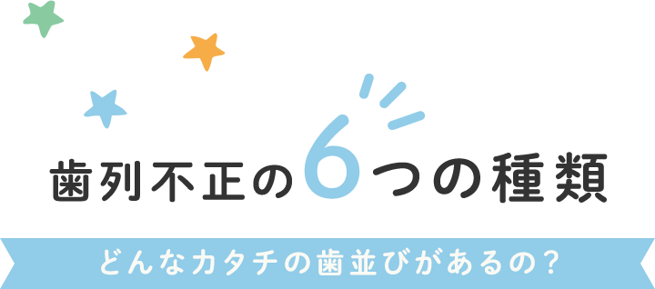 歯列矯正の6つの種類 どんなカタチの歯並びがあるの？